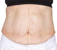 ageloc Galvanic Body Trio Itt az idő, hogy a világ egyik legmodernebb testkezelő rendszerével újabb szintre emelje az bőröregedés tudományát!