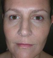 8 NU 2 Eredmények napi kétszeri ageloc Transformation kezelés alkalmazásával, valamint ageloc Edition Nu Skin Galvanic Spa System II készülék és a Nu Skin Galvanic Spa System Facial Gels with ageloc