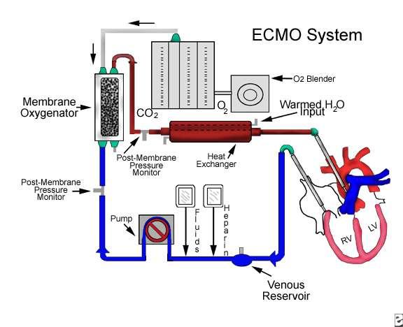 ACUT SZÍVELÉGTELENSÉG ESZKÖZÖS TERÁPIA ECMO Centrális Perifériás Venoarterial ECMO Venovenous ECMO Magasabb elérhető PaO 2. Alacsonyabb elérhető PaO 2. Alacsonyabb perfusio szükséges.