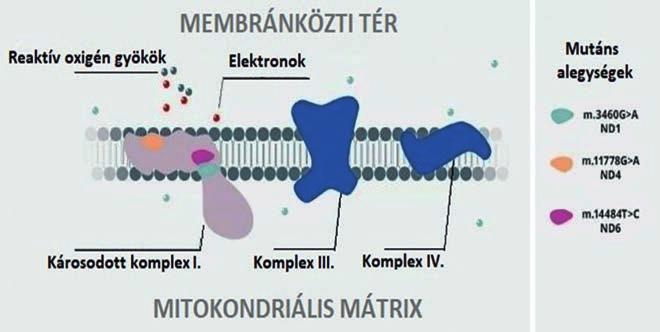 Idebenon kezeléssel szerzett klinikai tapasztalataink 1. ábra: A mitokondriális dns kóros I-es alegysége (forrás: www.santhera.