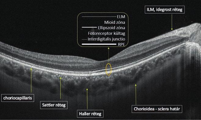 Importance of choroidal thickness in eye diseases 1.