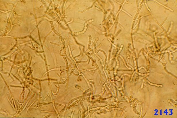 Trichophyton