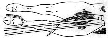 Baier-Schaetz-módszer lépései