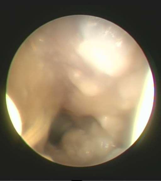 Baktériumok Mit látunk mi Staphylococcus spp 1.