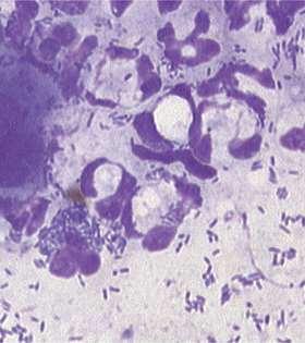 Citológia Nagy mennyiségű kokkoid/pálca (Pseudomonas spp) alakú