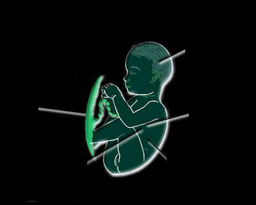 A magzati keringés jellegzetességeinek vizsgálata A,E G D C B,F Arteria umbilicalis Aorta descendens Arteria cerebri media Arteria renalis Vena umbilicalis Vena
