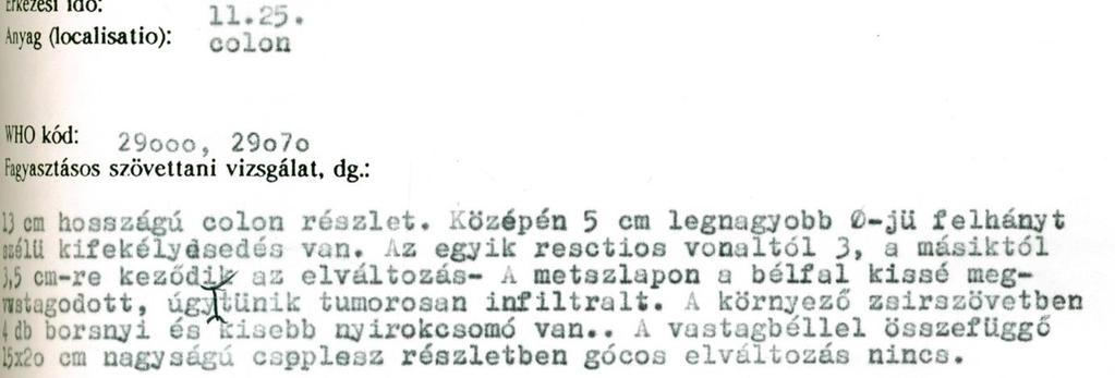 és