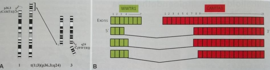 ko-aktivátor CAMTA1: calmodulin-kötő transzkripciós aktivátor 2.