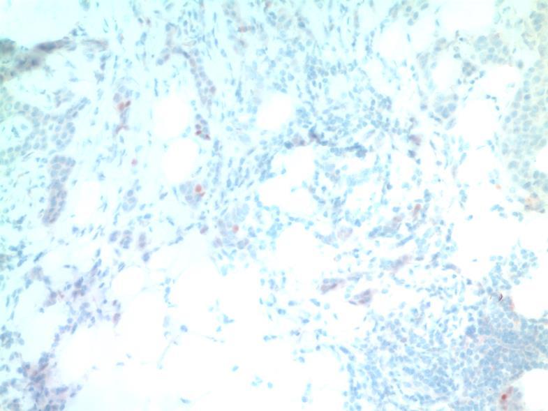 carcinoma bizonytalan