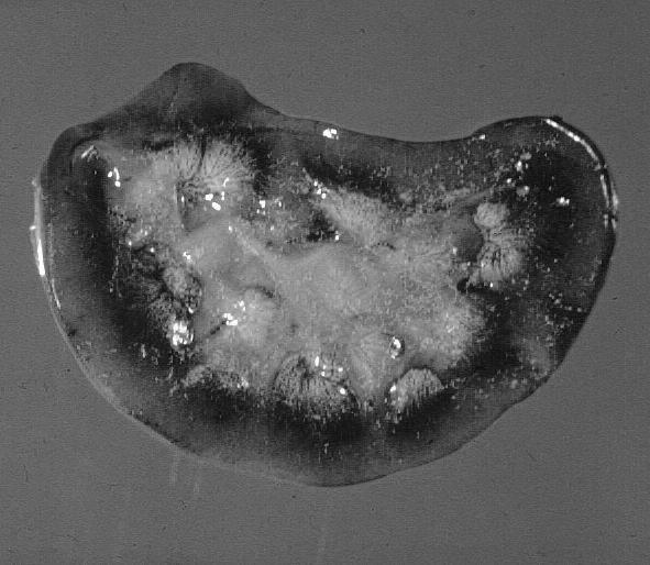 Uricosis,