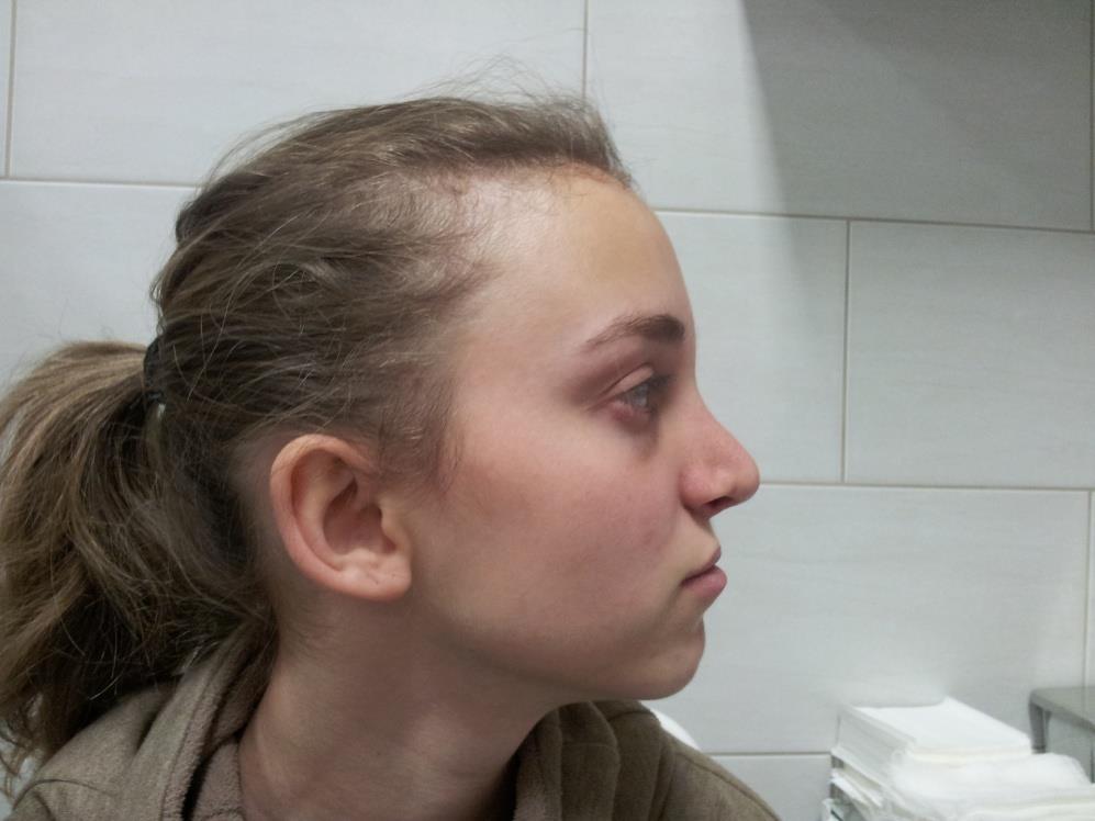 hónap)