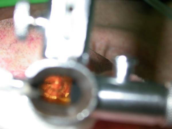 keresés Panendoscopia