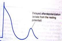 afterdepolarization Early