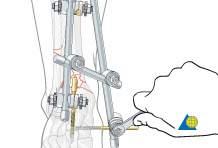 OPERATIVE -