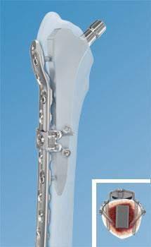 OPERATIVE -