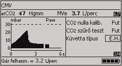 A készülék használata Tömlőtípus A beállított tömlő típusának egyeznie kell a csatlakoztatott tömlőével. Ellenkező esetben pontatlanná válhatnak a térfogatmérések.