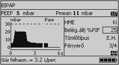 A készülék használata Nyomásemelkedési idő, Emelkedés (PC- BIPAP légvétel és Psupp nyomástámogatás esetén) NIV Nem invazív lélegeztetés Lásd a "Nem invazív légzés (NIV)" a 75. oldalon.