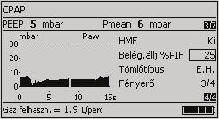A készülék használata Spn-CPAP, Spn-CPAP/PS SpnCPAP Spontán légzés folyamatos pozitív légúti nyomáson (Spontaneous Continuous Positive Airway Pressure) Kielégítő spontán légzésű páciensek számára.