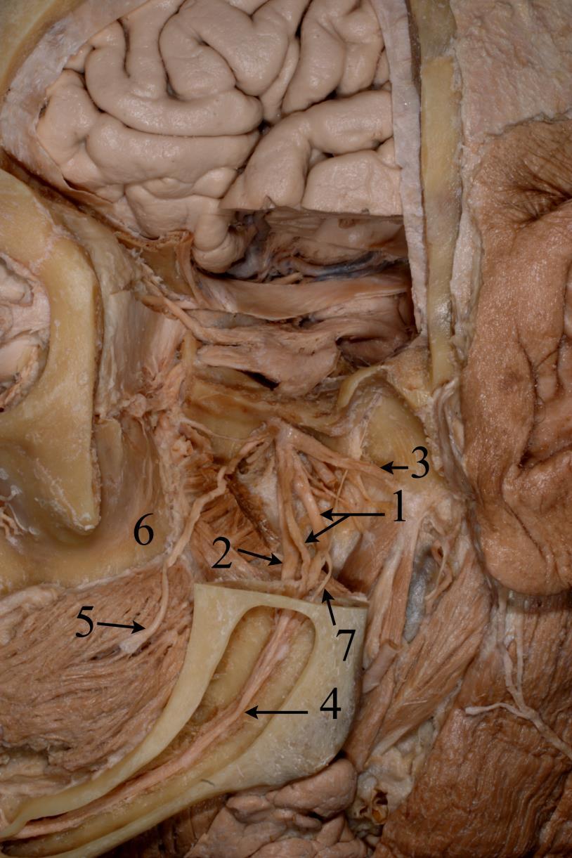 lingualis N. alveolaris inf.