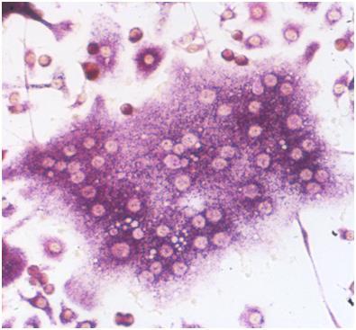 2.2. Oszteoklasztok Az oszteoklasztok, vagy más néven csontfaló sejtek sokmagvú hematopoietikuseredetű specializált makrofágok, melyek átmérője akár több száz μm is lehet. (5.