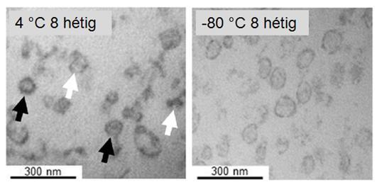 Western blot mérések eredménye alapján hosszabb ultracentrifugálási periódus hatására nagyobb mennyiségben volt jelen az exoszómákra jellemző CD63 tetraspanin molekula a preparátumokban, illetve a