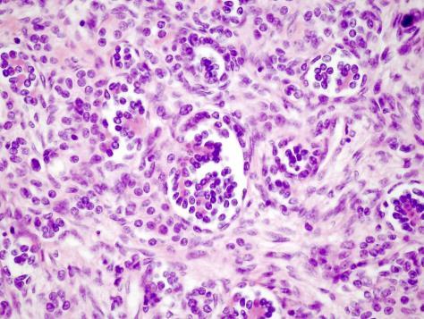 elemek Epithelialis sejtek glomerulus és