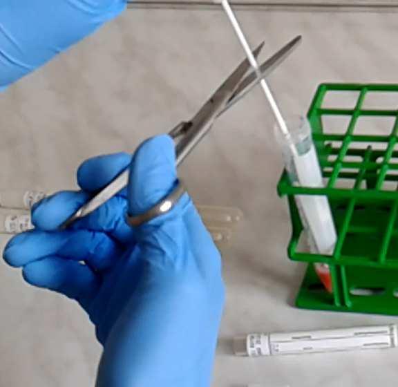 Mycoplasma transzport rendszer MS Védekezési lehetőségek Rövid távú Antibiotikumos gyógykezelés