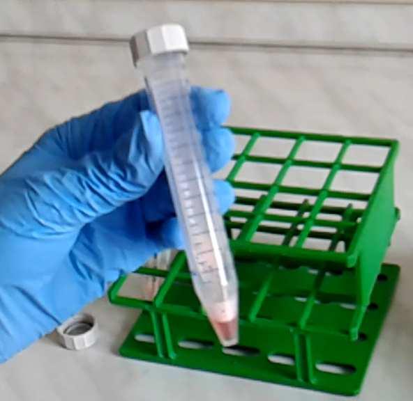 aminociklitolok: spektinomicin linkózamid: linkomicin tetraciklinek:doxiciklin,