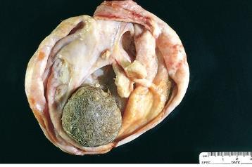 chondromyxoid) Ectodermalis eredet Elsevier, Diagnostic Histopathology of Tumors, 4th.ed. C.