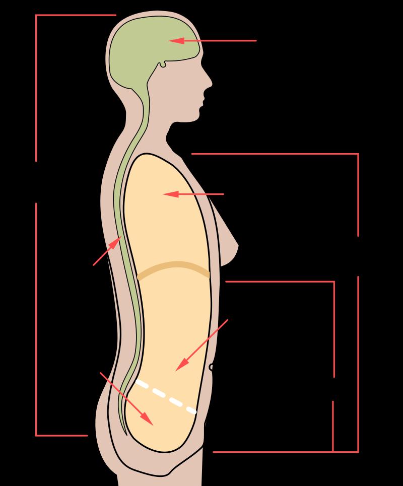 A metastasis képződés módjai 1. Implantáció (testüregeken belüli terjedés) tu.
