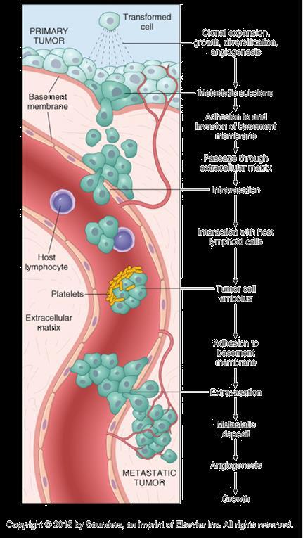 Metastaticus kaszkád A hematogén áttétek kialakulásának lépései Tumorsejtek elválása egymástól Basalis membrán és extracellularis