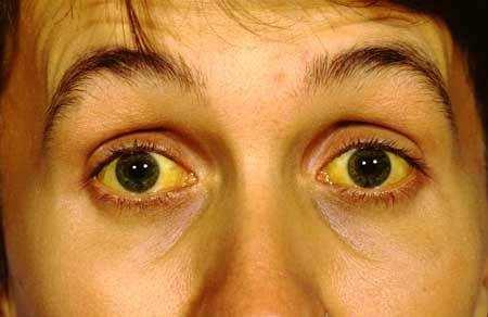 Conjuctiva