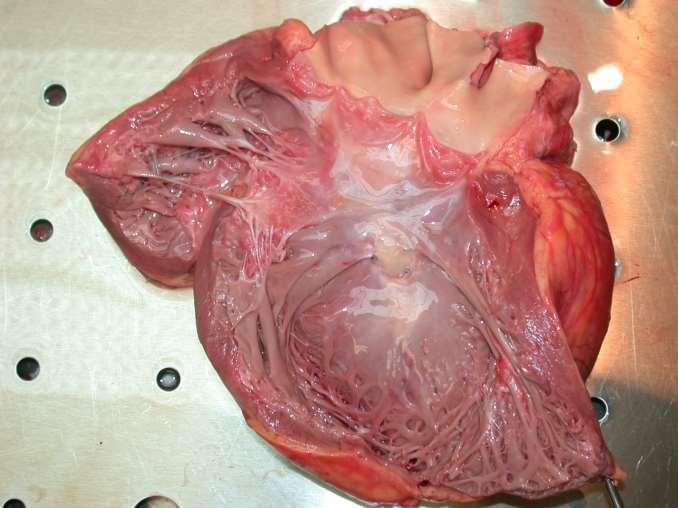 tricusp. insuff. dilatatio ventr., fixált pulm. hypertonia progr.