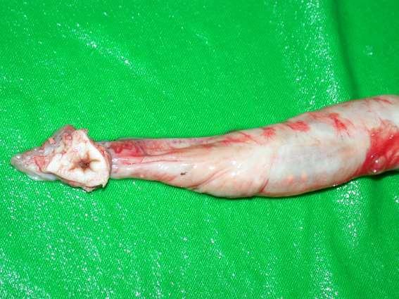 anus