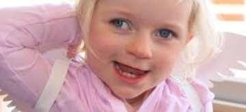 UBE3A codes for an E6-AP ubiquitin ligase "happy puppet syndrome", developmental delay, functionally severe speech impairment,