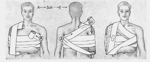 Clavicule