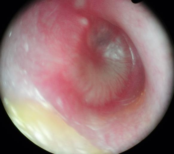 2. anterior-inferior quadráns (AI) 3. posterior-superior quadráns (PS) 4.