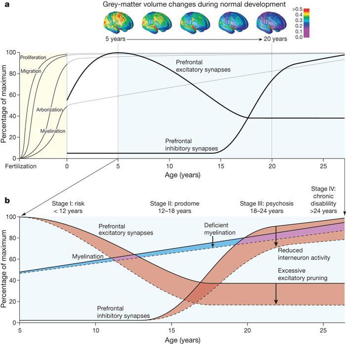 Szkizofrénia neurodevelopmentális elmélete Az agyi fejlődés abnormalitása neurodegeneratív