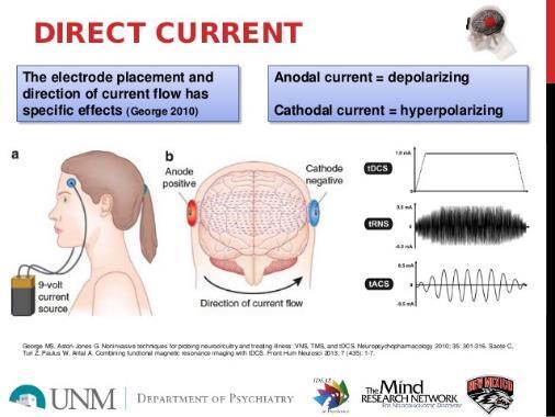 Non Invasive Brain