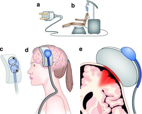 transcranial Direct