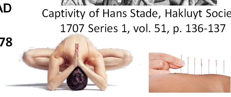 Lancet 1997: 350 (9075); pp437