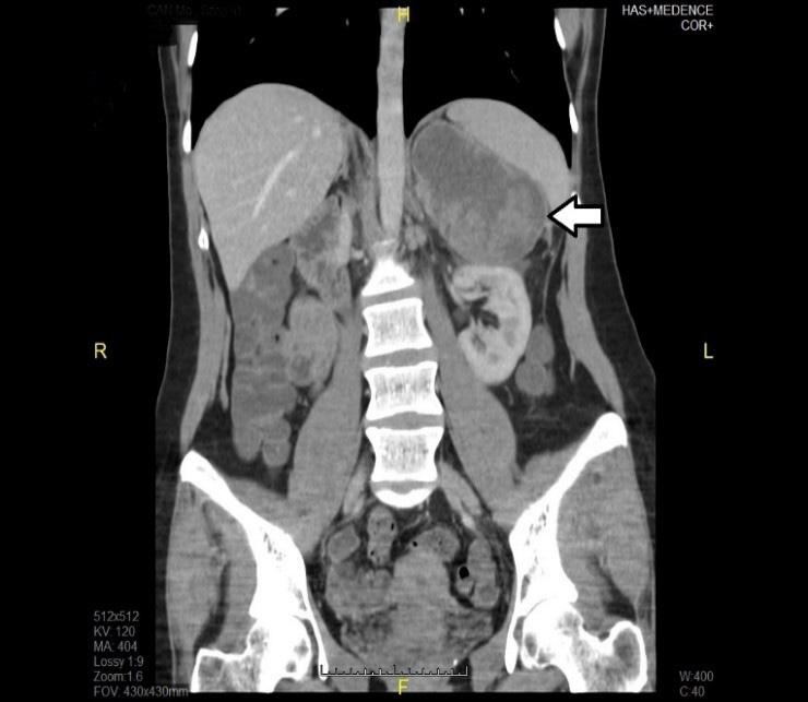 multiplex endokrin neoplasia; MI = minimálisan invazív; MRI = (magnetic resonance imaging) mágneses rezonanciás képalkotás; NIH = (National Institutes of Health) Nemzeti Egészségügyi Intézet; NSAID =