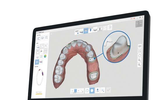 Form 3B 3D nyomtató tó intraorális szkenner A digitális
