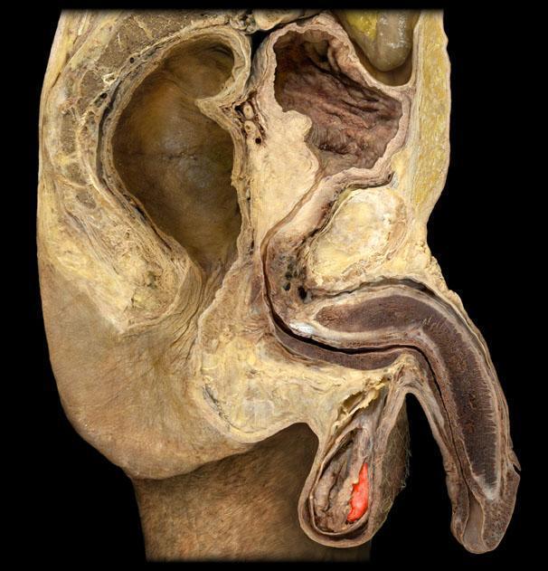 Testis