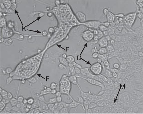 A herpes simplex vírusok szaporodására az immunrendszer határozott szisztémás válasszal reagál, amely mind humorális, mind celluláris mechanizmusokat felölel.