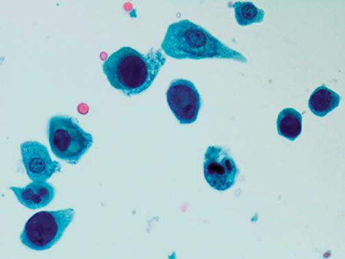 A Merkel-sejt carcinomából kimutatott ötödik polyomavírus elnevezése a sejtvonalra utal: Merkel-sejt polyomavirus (MCV vagy MCPyV).