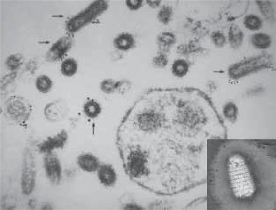 3.2.20. ábra. Vesicular stomatitis virus immun-elektronmikroszkópos képe. A vírusrészecskék a G protein ellen termelt kolloidális aranyszemcsékhez kötött ellenanyag segítségével azonosíthatók (Dr.