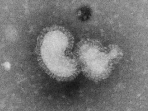 3.2.25. ábra. Az influenzavírus (A/H3N2) negatív-festésű elektronmikroszkópos képe. A felszínen a hemagglutinin (HA) és neuraminidáz (NA) tüskék láthatók.