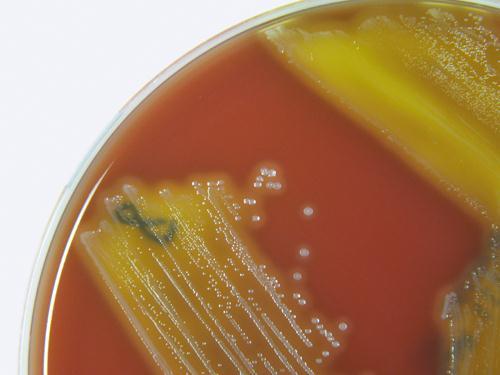 3.3.5. a. ábra. A Streptococcus pyogenes mikroszkópos és telepmorfológiája. A: Streptococcus sejtek láncokban, Gram-festés, B: Béta hemolizáló S. pyogenes telepek.