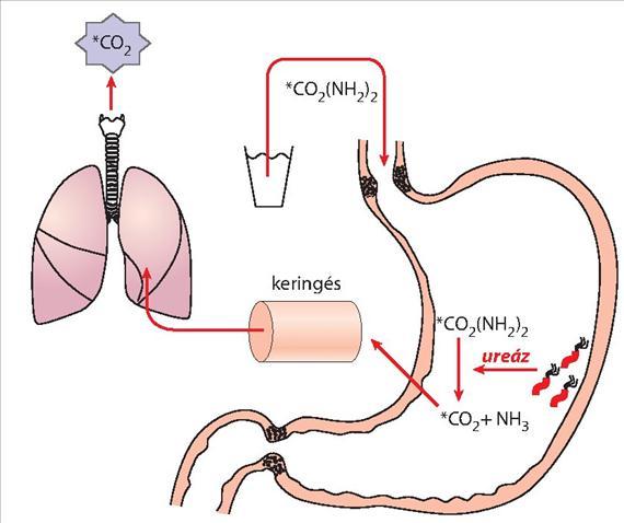 A biopsziás mintából akár a kezelőorvos által is elvégezhető gyors eljárás a nevében még a campylobacter rokonságra utaló (Campylobacter Like Organism) CLO teszt, vagy gyors ureáz teszt.
